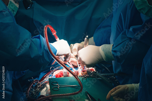 Surgical room in hospital with medical team of surgeons doing minimal invasive surgical interventions. Surgery operating room with electrocautery equipment for cardiovascular emergency surgery center. photo