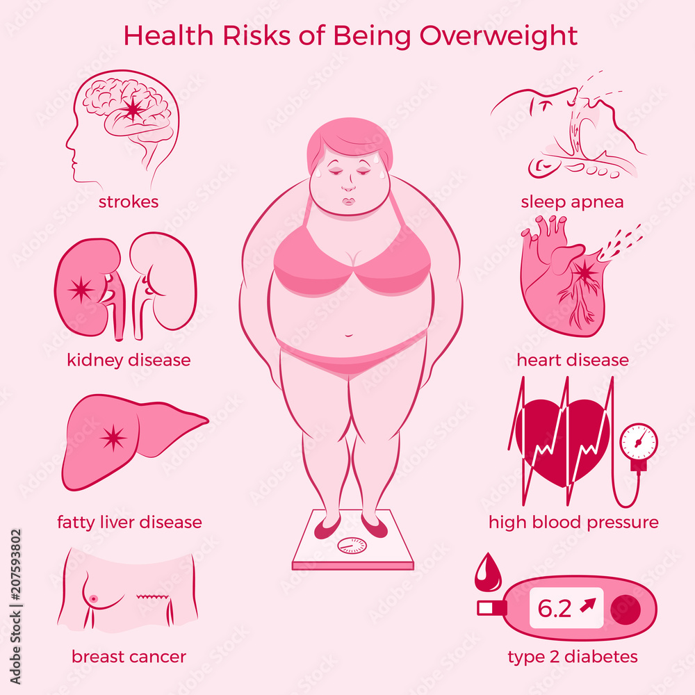 Health Risks of Being Overweight Set. Medicine, pathology, anatomy, physiology, health. Vector