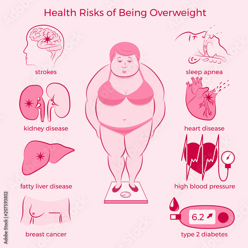 Health Risks of Being Overweight Set.  Medicine, pathology, anatomy, physiology, health. Vector illustration. Healthcare poster or banner template.

