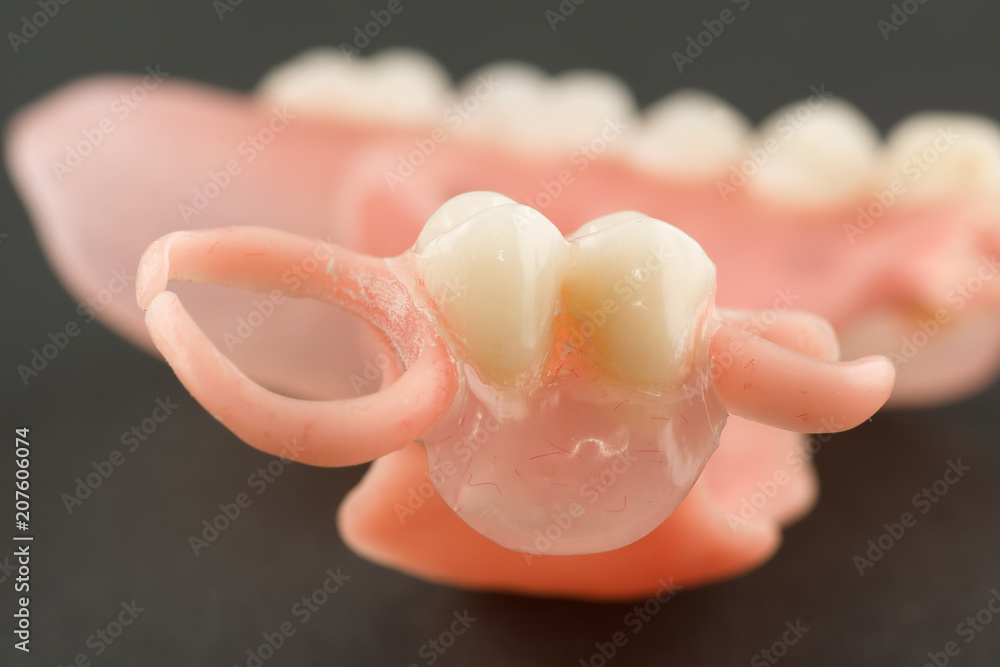 Fotografie large image of a modern denture