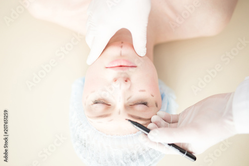 Upsidedown overview of young patient having some of her facial areas marked by plastic surgeon before lifting surgery
