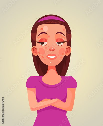 Sad unhappy teen girl woman with acne on face. Skin problem flat cartoon illustration graphic design concept element