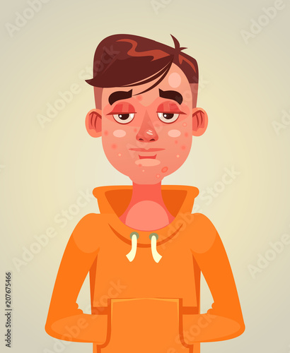 Sad unhappy teen boy man with acne on face. Skin problem flat cartoon illustration graphic design concept element 
