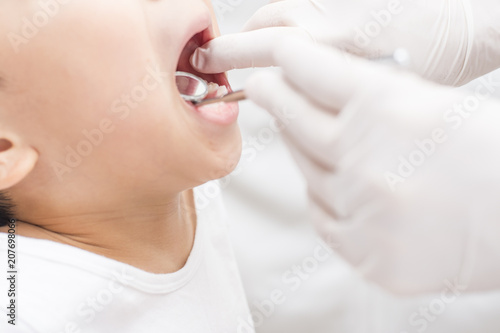 Kontrola zębów