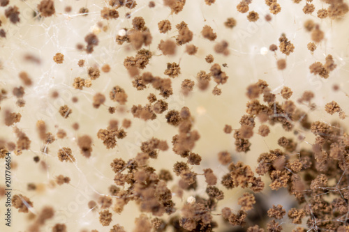 Rhizopus (bread mold) is a genus of common saprophytic fungi,Rhizopus (bread mold) under the microscope. 