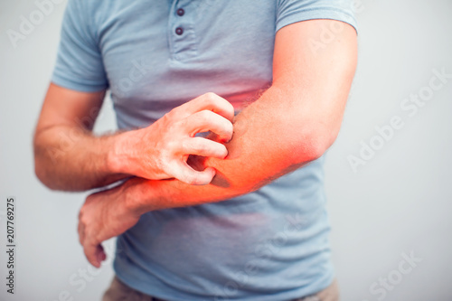 People scratch the itch with hand, Elbow, itching, Healthcare And Medicine, Men with skin problem concept photo