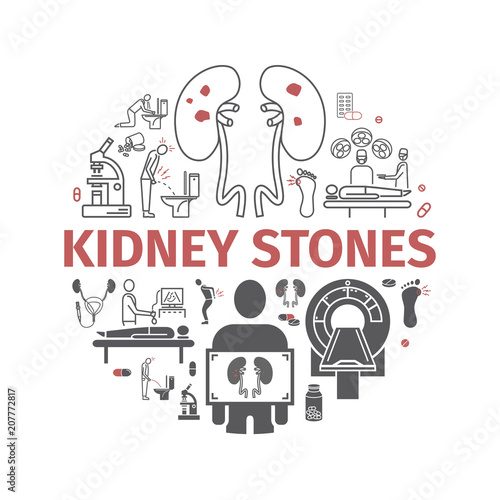 Kidney stones banner. Symptoms, Treatment. Line icons set. Vector signs for web graphics.
