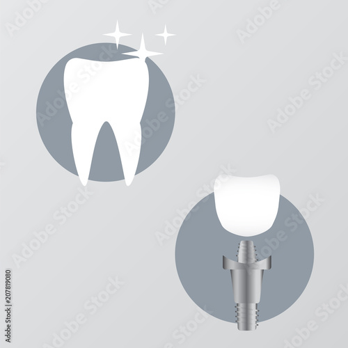 Tooth anatomy and damage. Healthy teeth and dental implant