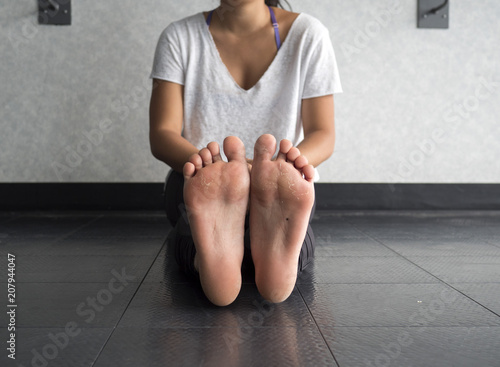 Bottom view of callused feet photo