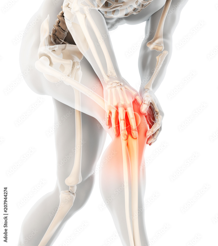 Knee painful - skeleton x-ray. - obrazy, fototapety, plakaty 
