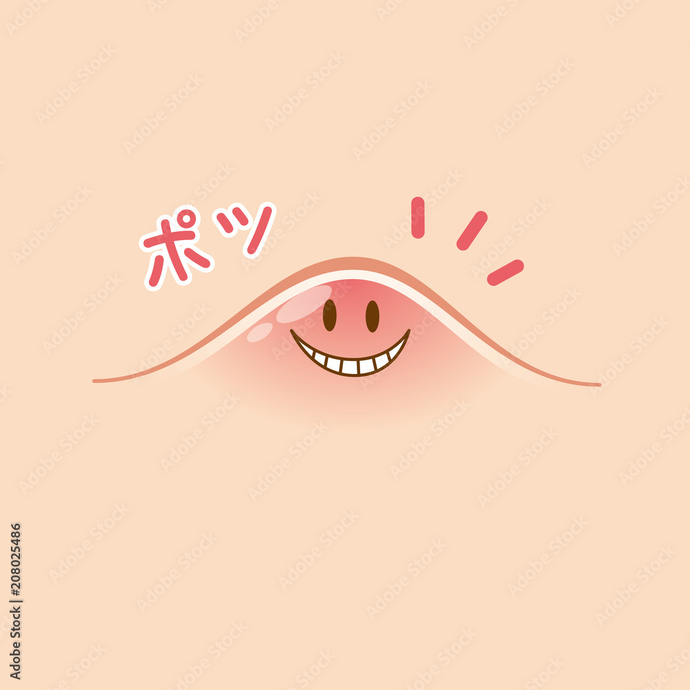 ニキビ 吹き出物 Stock イラスト Adobe Stock ニキビ 吹き出物 Stock イラスト Adobe Stock