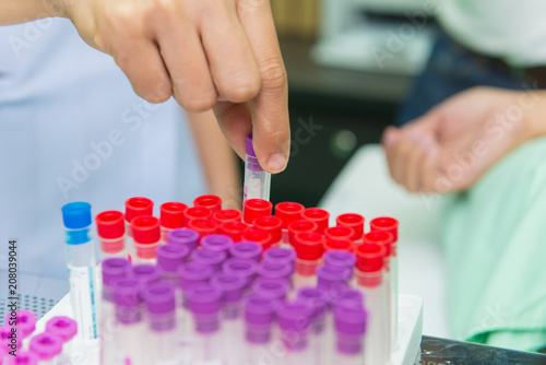 hand holding tube with collection blood samples in laboratory at hospital