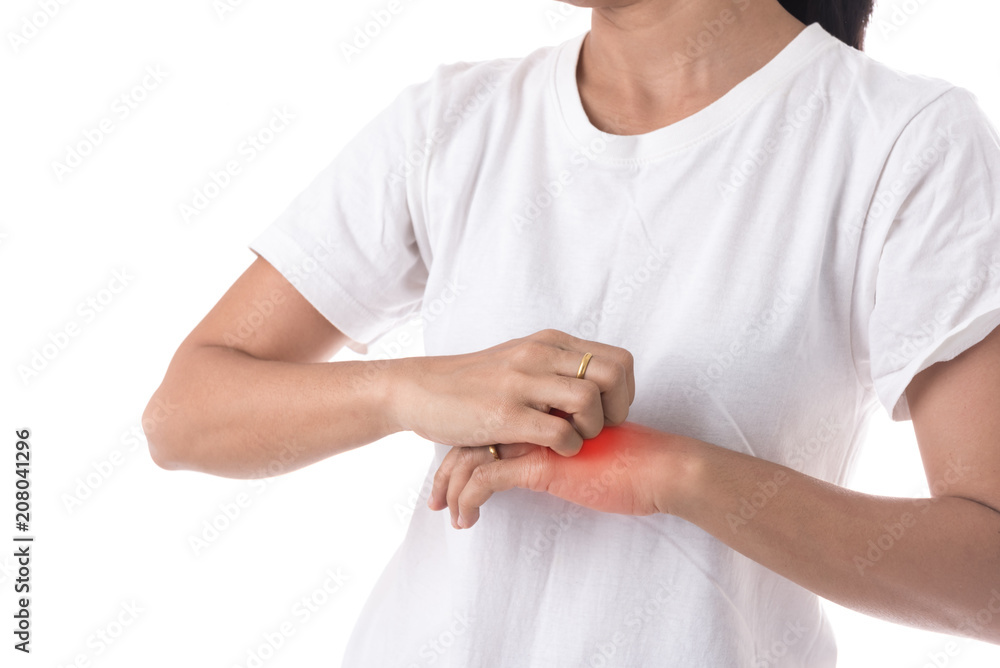 Girl scratch the itch with hand, Arm, Itching, Concept with Healthcare And Medicine. Girl scratch the itch with hand, Arm, Itching, Concept with Healthcare And Medicine.