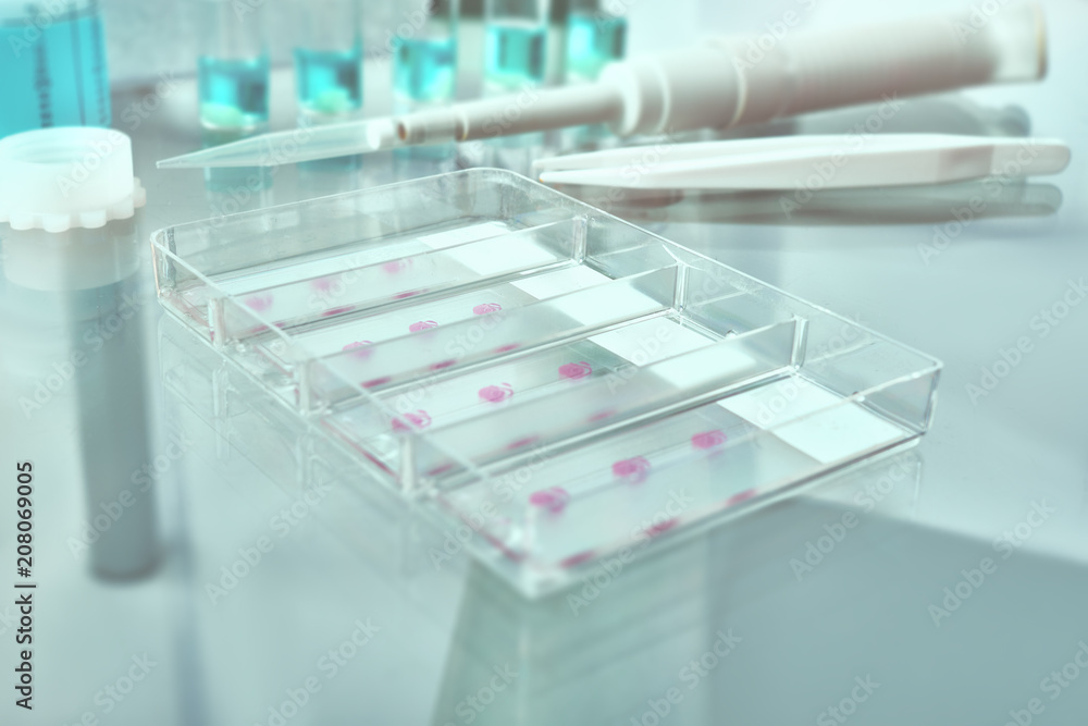 Tissue sections, battery of jars with fixed tissue samples on glass. Toned image, text space. Tissue sections, battery of jars with fixed tissue samples on glass. Toned image, text space.