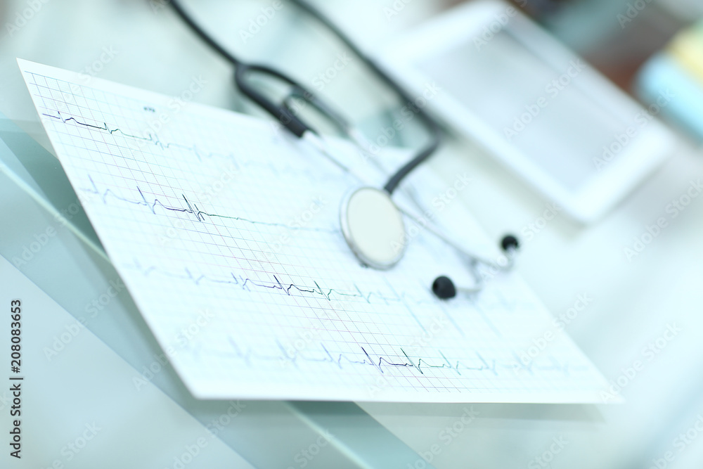 stethoscope and cardiogram on a medical table stethoscope and cardiogram on a medical table