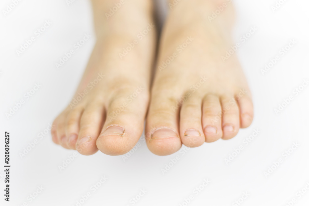 Dirty feet of a little boy's feet. Dirt under the fingernails. On a white background. Dirty feet of a little boy's feet. Dirt under the fingernails. On a white background.
