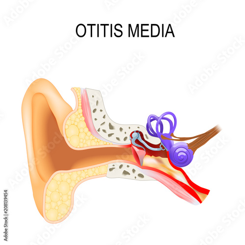 Otitis media. Human anatomy. photo