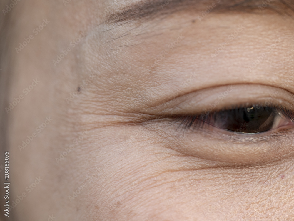 Obraz premium Wrinkles around the eyes