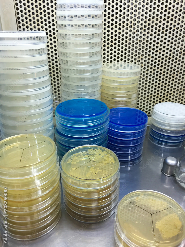 Blue agar CAS assay used for siderophore detection and white