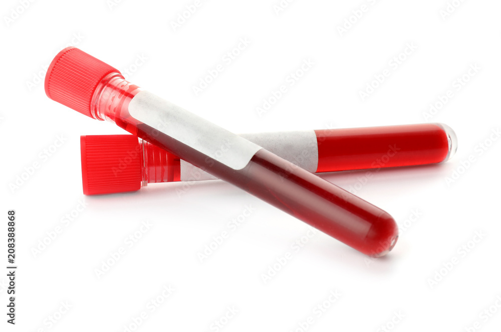 Test tubes with blood samples on white background Test tubes with blood samples on white background