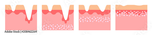 collagen in younger skin and aging vector version