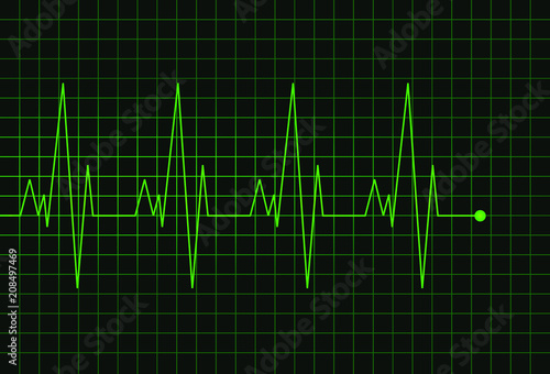 Cardiogram heartbeat. Abstract green line electrocardiogram on dark green grid. Medical wave chart. Vector background