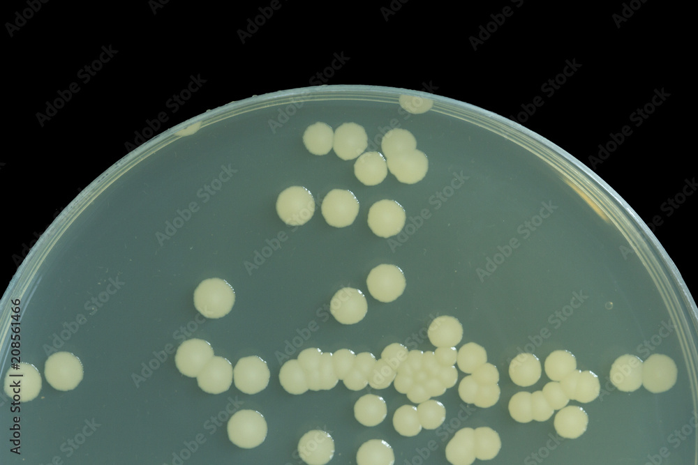 Bacillus sp. on Trypticase soy agar agar plate . Colony bacteria on