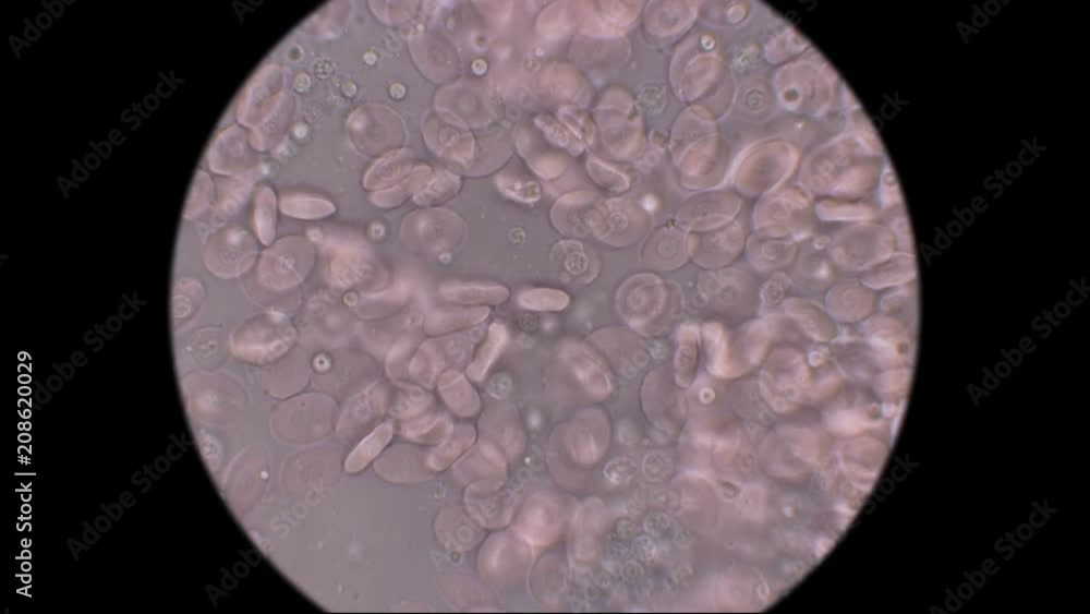 blood of a fish under a microscope blood of a fish under a microscope