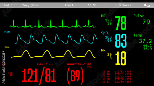 Monitoring of patient's condition, vital signs on ICU monitor in hospital. 3D illustration photo