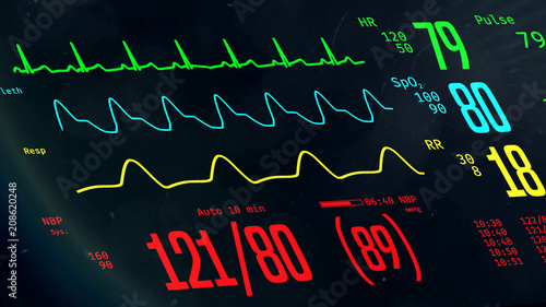 ICU monitor with stable vital signs, doctors monitoring patient's condition. 3D illustration