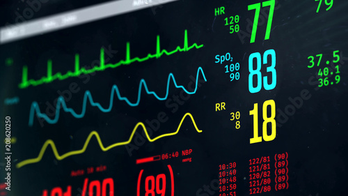 Normal vital signs on bedside ICU monitor, patient stable after heart surgery. 3D illustration photo