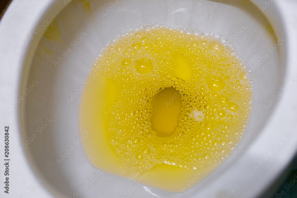 Users who forget to flush the toilet Fresh urine is yellow in the Users who forget to flush the toilet Fresh urine is yellow in the