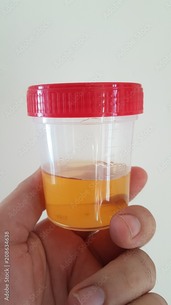 urine specimen plastic box and hand urine specimen plastic box and hand