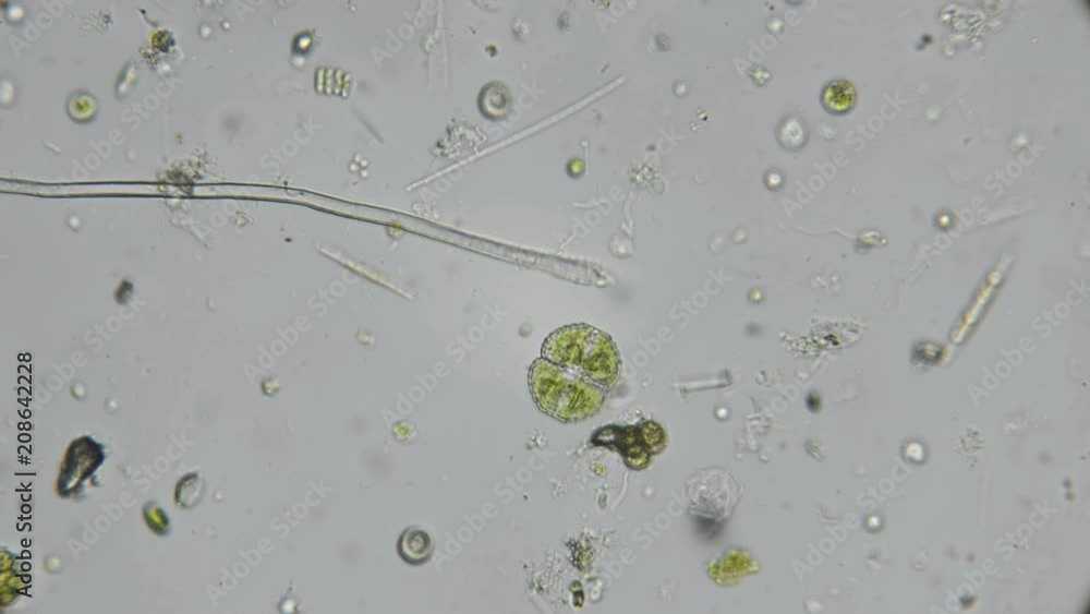 a drop of water from a dirty pond under a microscope, with a multitude of