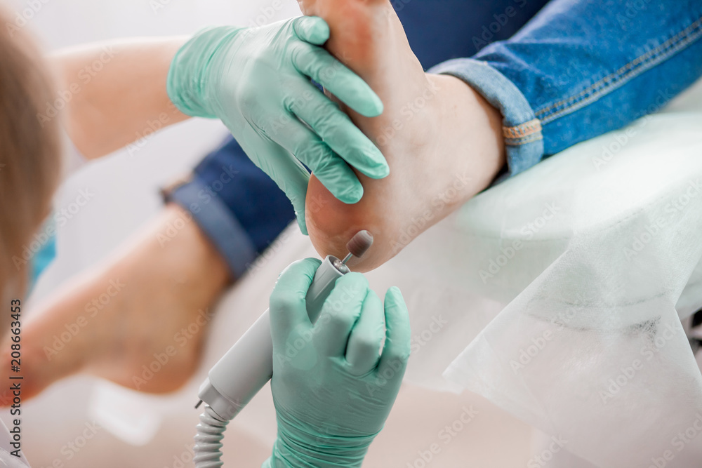 Podiatry doctor. Treatment of feet and nails. Podiatry doctor. Treatment of feet and nails.