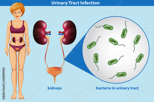 Human Anatomy of Urinary Tract Infection