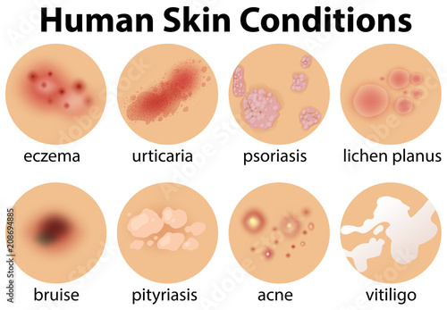 A Set of Human Skin Conditions