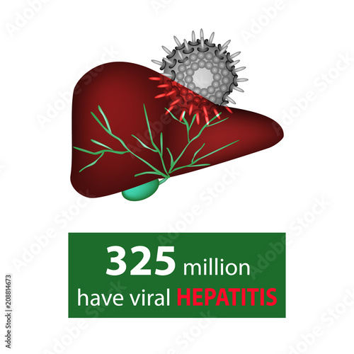 325 million have viral hepatitis. Liver and hepatitis virus. World Hepatitis Day. Infographics. Vector illustration on isolated background.