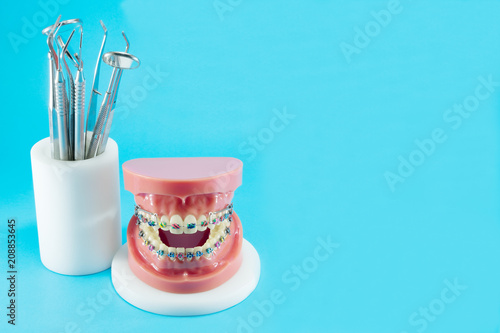 orthodontic model and dentist tool - demonstration teeth model of varities of orthodontic bracket or brace photo