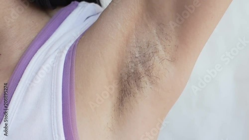 armpit, female hair growth, preparation for hair removal photo