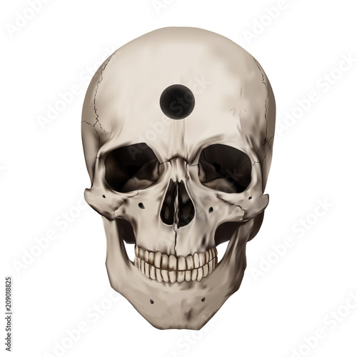 Human realistic skull with a hole. Trepanation, ancient surgery. White background. Anatomy vector illustration.