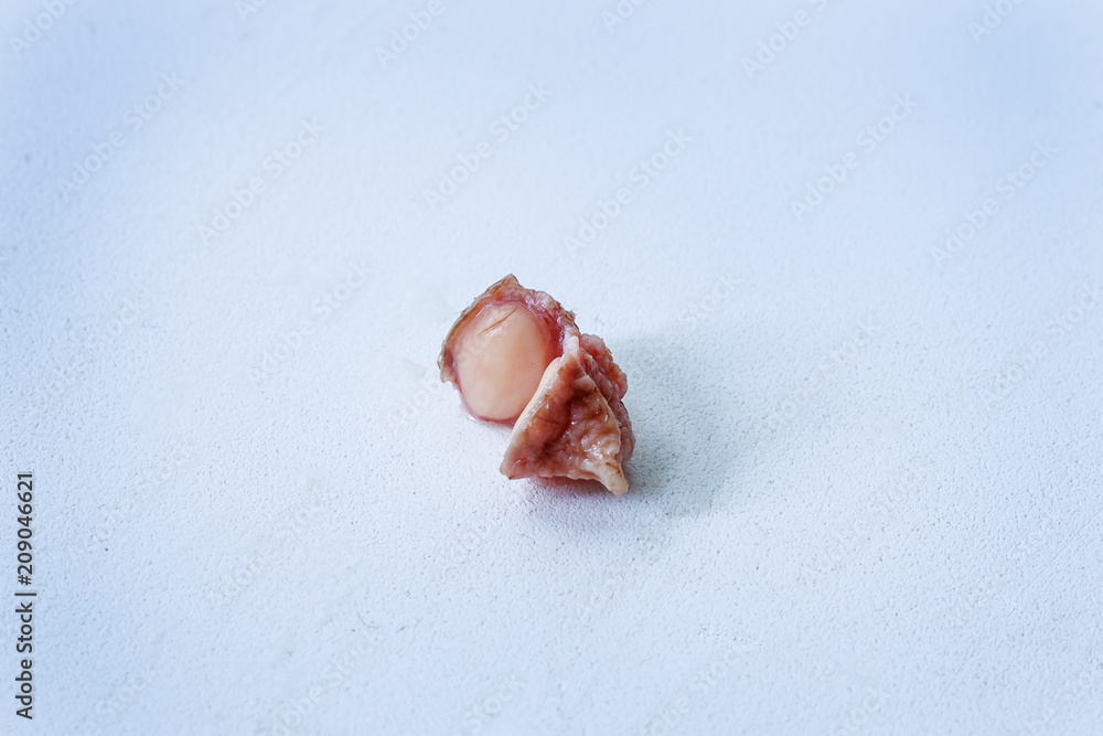 Fibroma, mole close-up in a cut on a white background