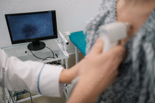 Closeup of dermatologist women examining mole by joystic with ca photo