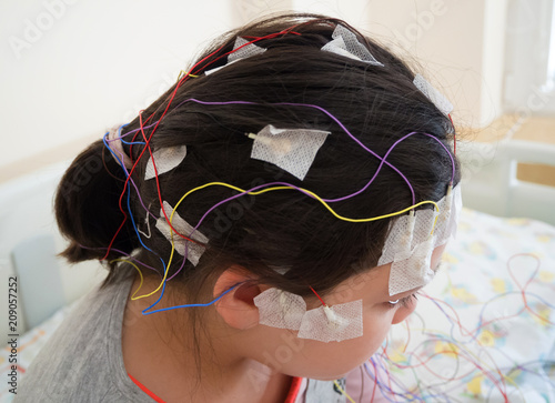 Girl with EEG electrodes attached to her head