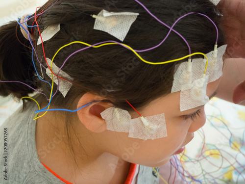 Girl with EEG electrodes attached to her head