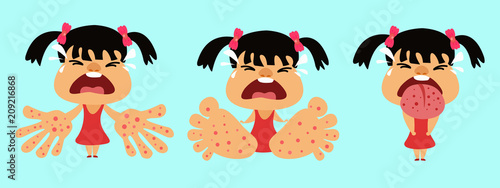 HFMD children infected. hand foot and mouth disease. Girl infected enterovirus. Cartoon vector illustration