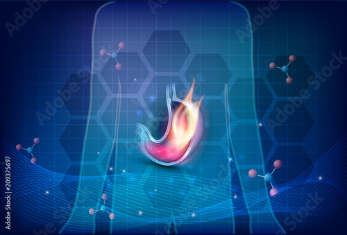 Human silhouette with burning stomach on a dark blue scientific background photo