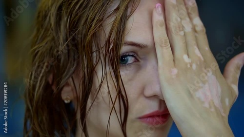 close up. face and palm of a middle-aged woman with vitiligo endocrine skin disease photo