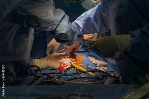 Doctors team wear blue coat perform heart surgery at the operating room in the hospital.
