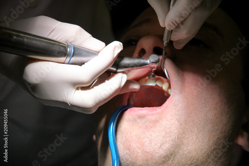 Dental check up. Dental male patient at regular dental check  at dental clinic and office. Man with dental suction tube in mouth. Healthcare and medical. Dentistry and oral hygiene. Dentist Concept.